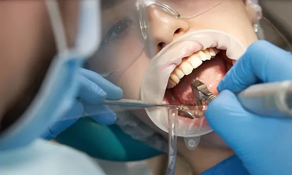 Emergency Dentistry