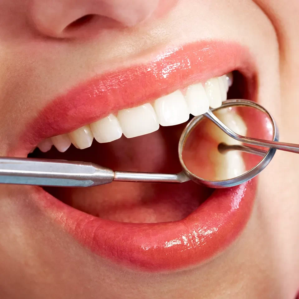 Dental Bridges in Markham