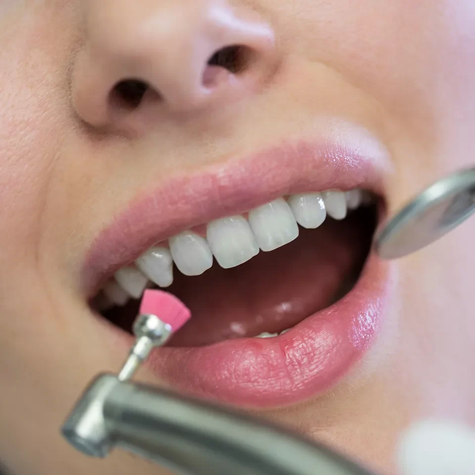 Dental Exams & Cleanings in Markham