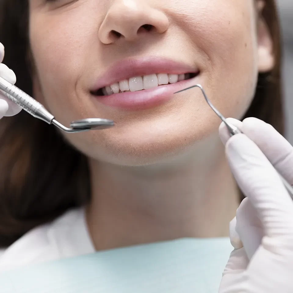 Dental Veneers in Markham