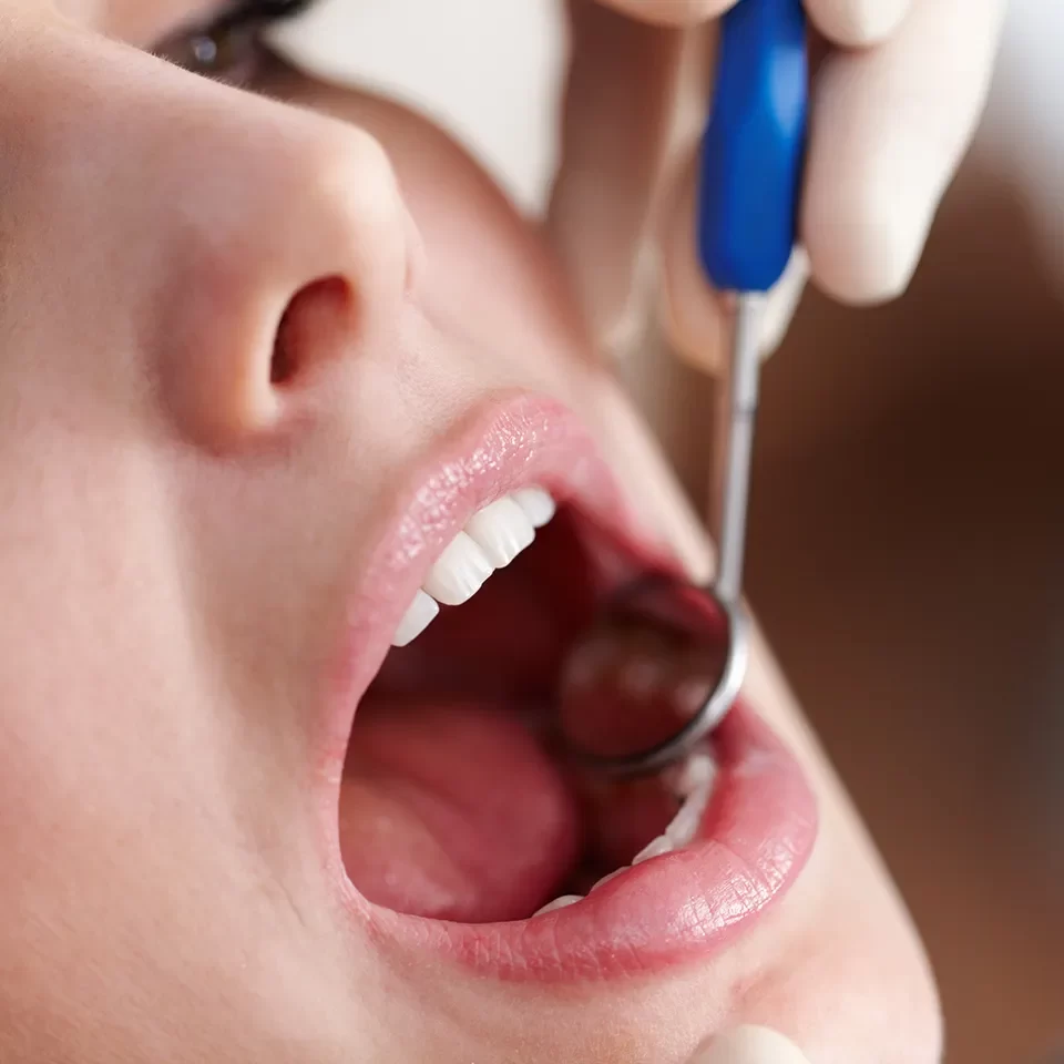 Emergency Dentistry in Markham