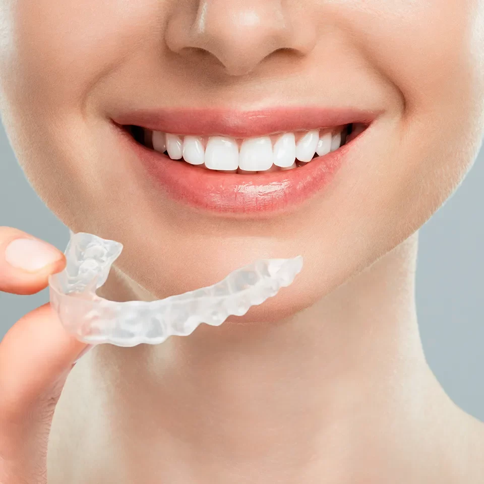 Invisalign in Markham
