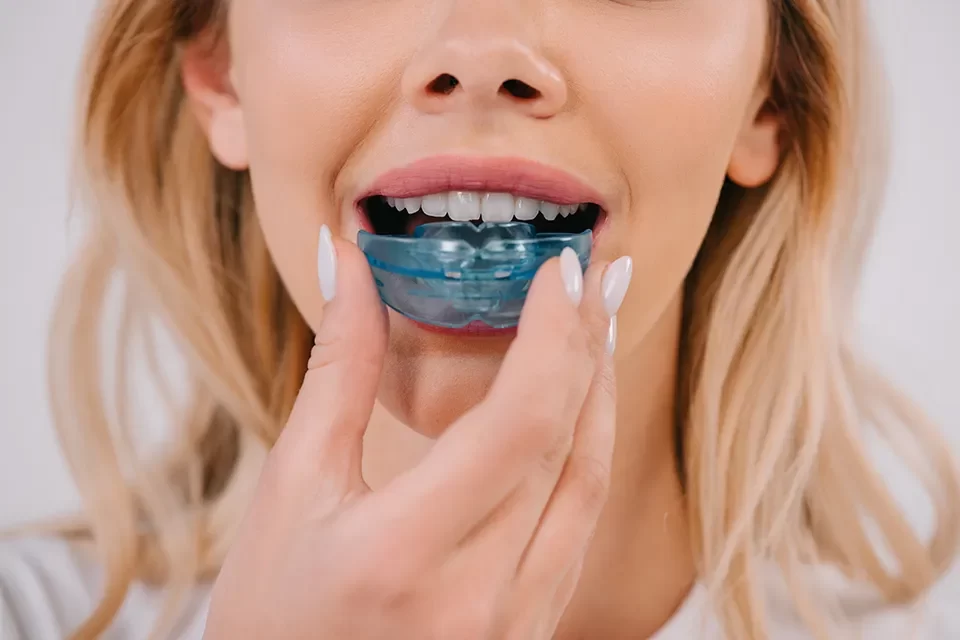 Night Guards & Mouthguards in Markham