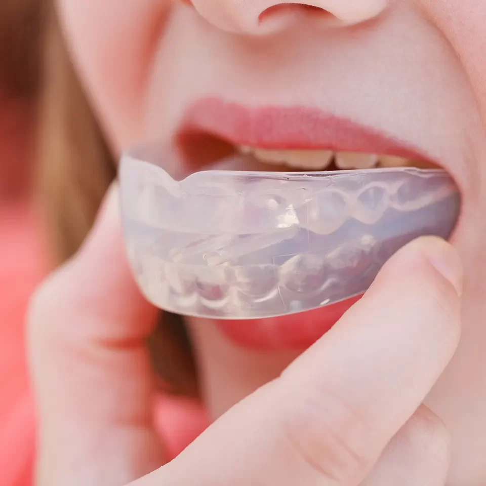 Night Guards & Mouthguards in Markham