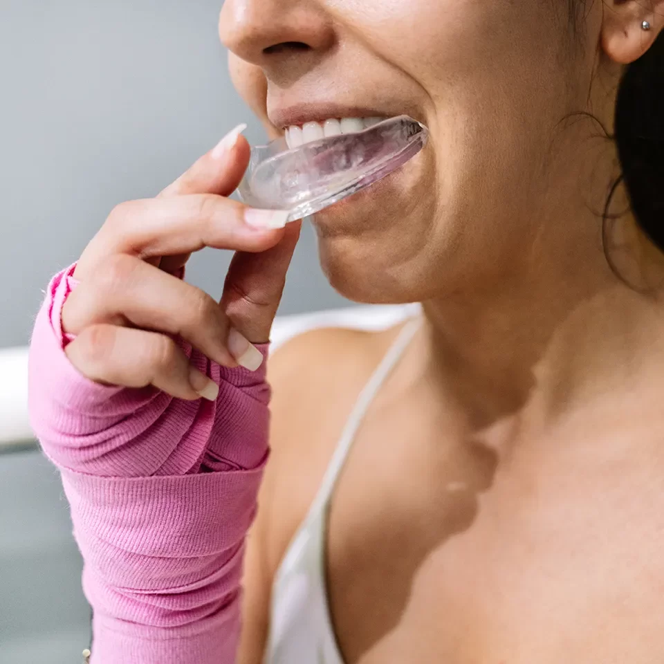 Night Guards & Mouthguards in Markham