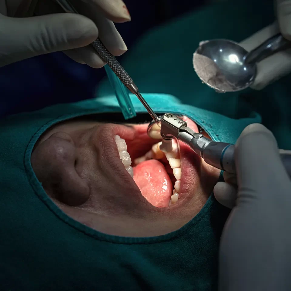 Oral Surgery in Markham
