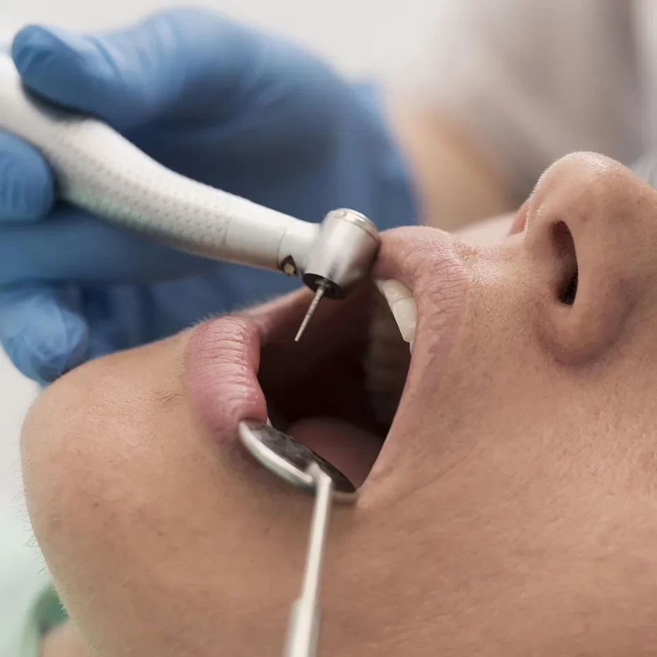 Tooth Extractions in Markham